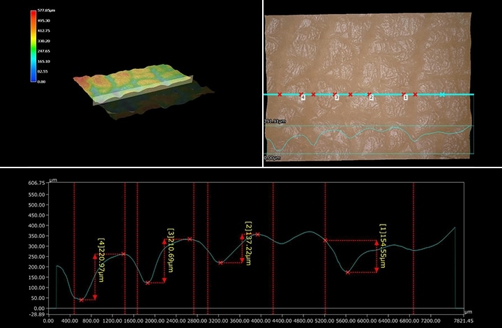 Perfil 3D de la superficie de la piel