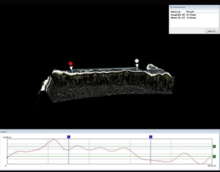 Medición de la forma 3D y de perfiles de endoprótesis bioabsorbibles