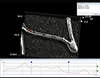 Medición de la forma 3D y de perfiles de endoprótesis bioabsorbibles